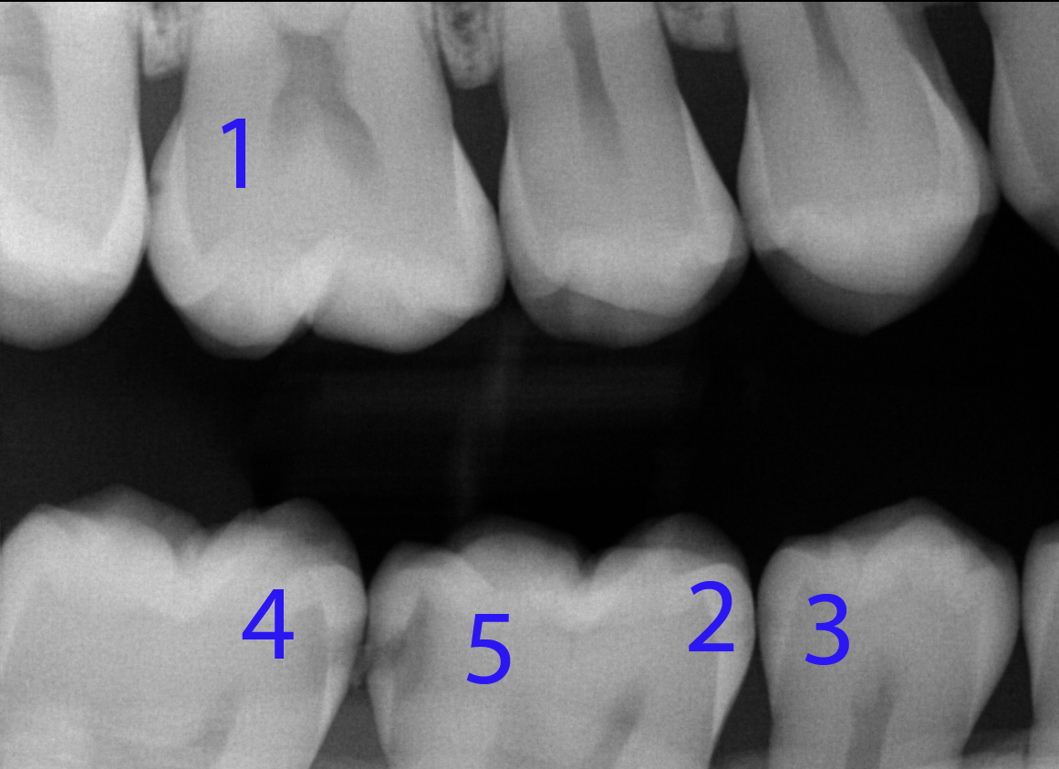 Dental XRays Moss Vale Dental Trusted Moss Vale Dentist